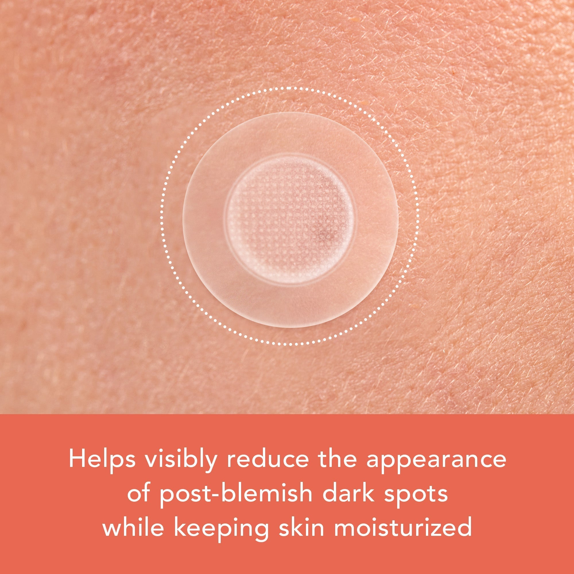 Miracle Patch Microcrystal Vitamin C Dark Spot Cover