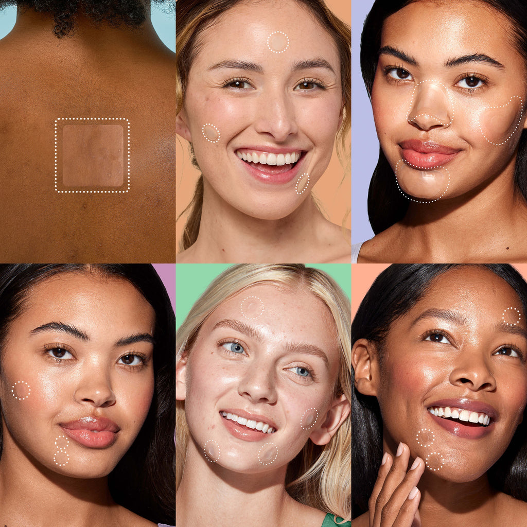 Miracle Patch Ultimate Blemish Patch Kit