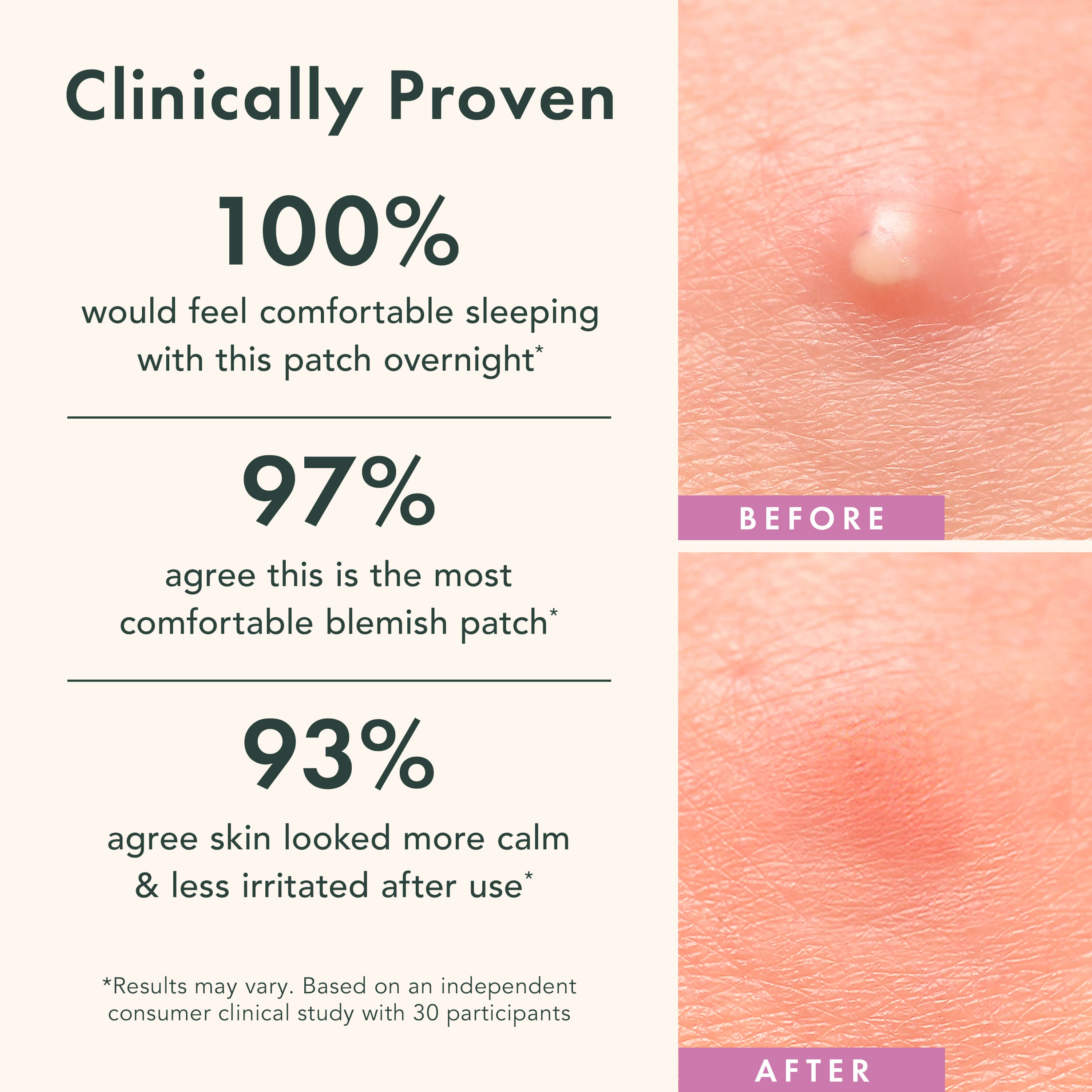 Miracle Patch Overnight Spot Cover