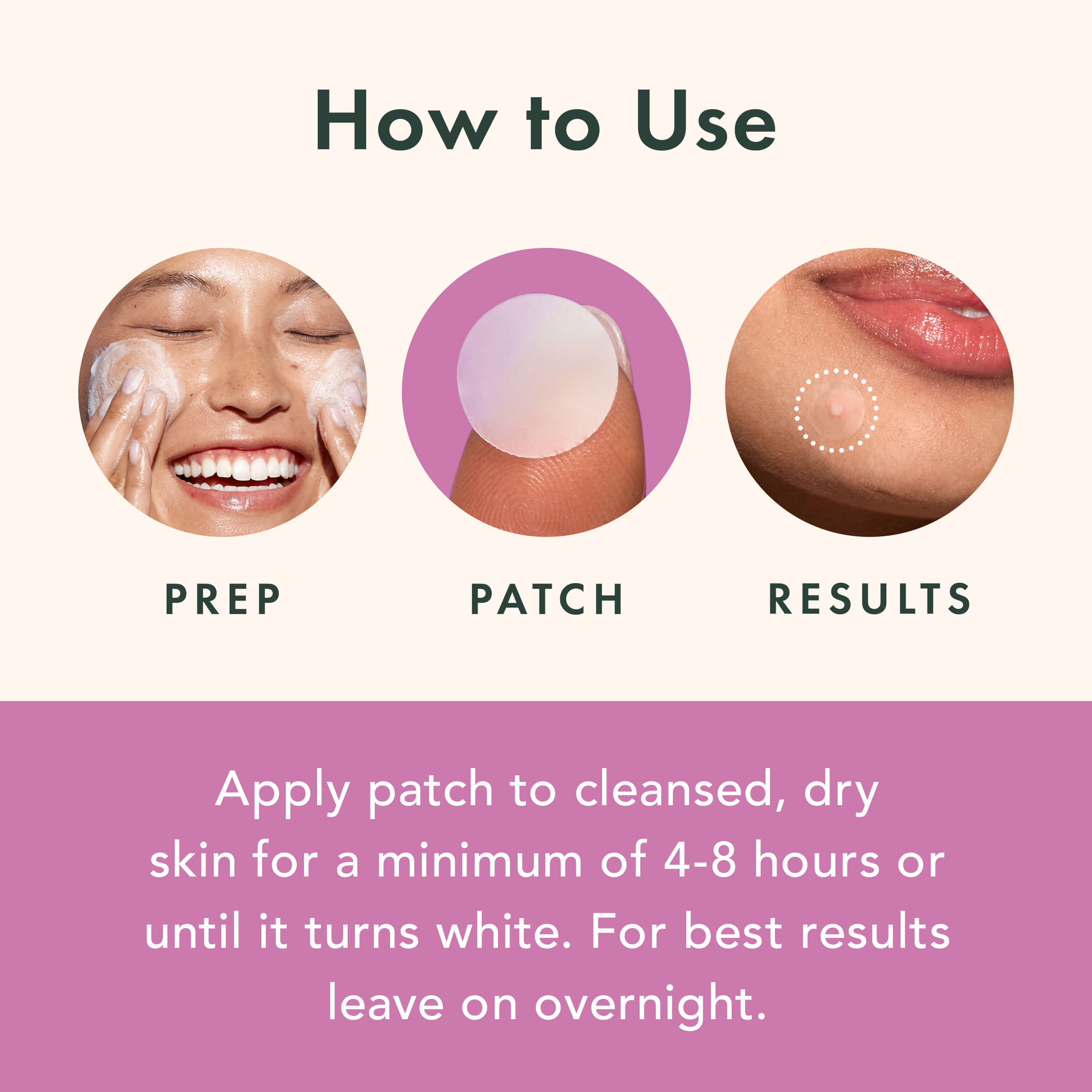 Miracle Patch Overnight Spot Cover
